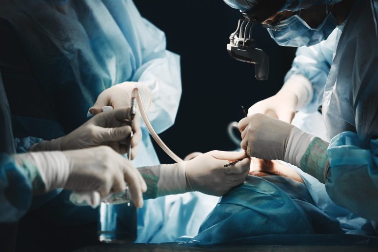 In Lansing, surgeons in blue scrubs diligently perform a procedure, using precision tools and wearing surgical magnifying glasses, with focused lighting on the patient to prevent any hint of medical malpractice.